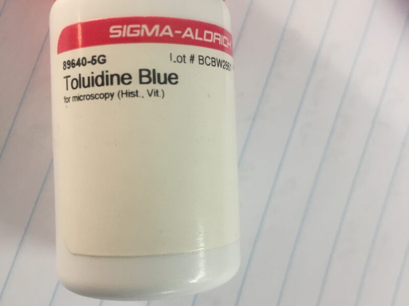 Toluidine Blue